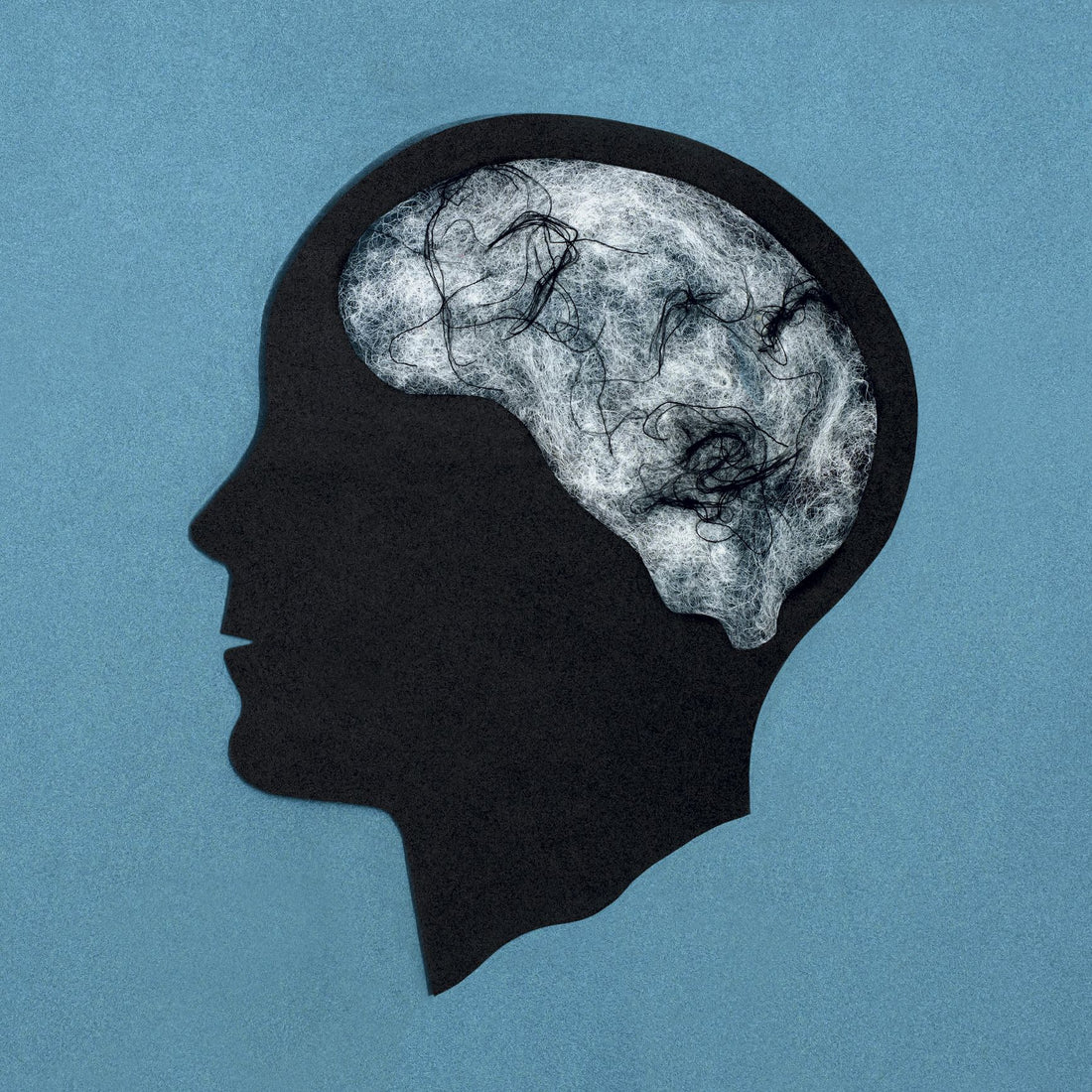 Cannabis Withdrawal Brain Fog: Why It Happens and 5 Ways to Clear Your Mind Fast